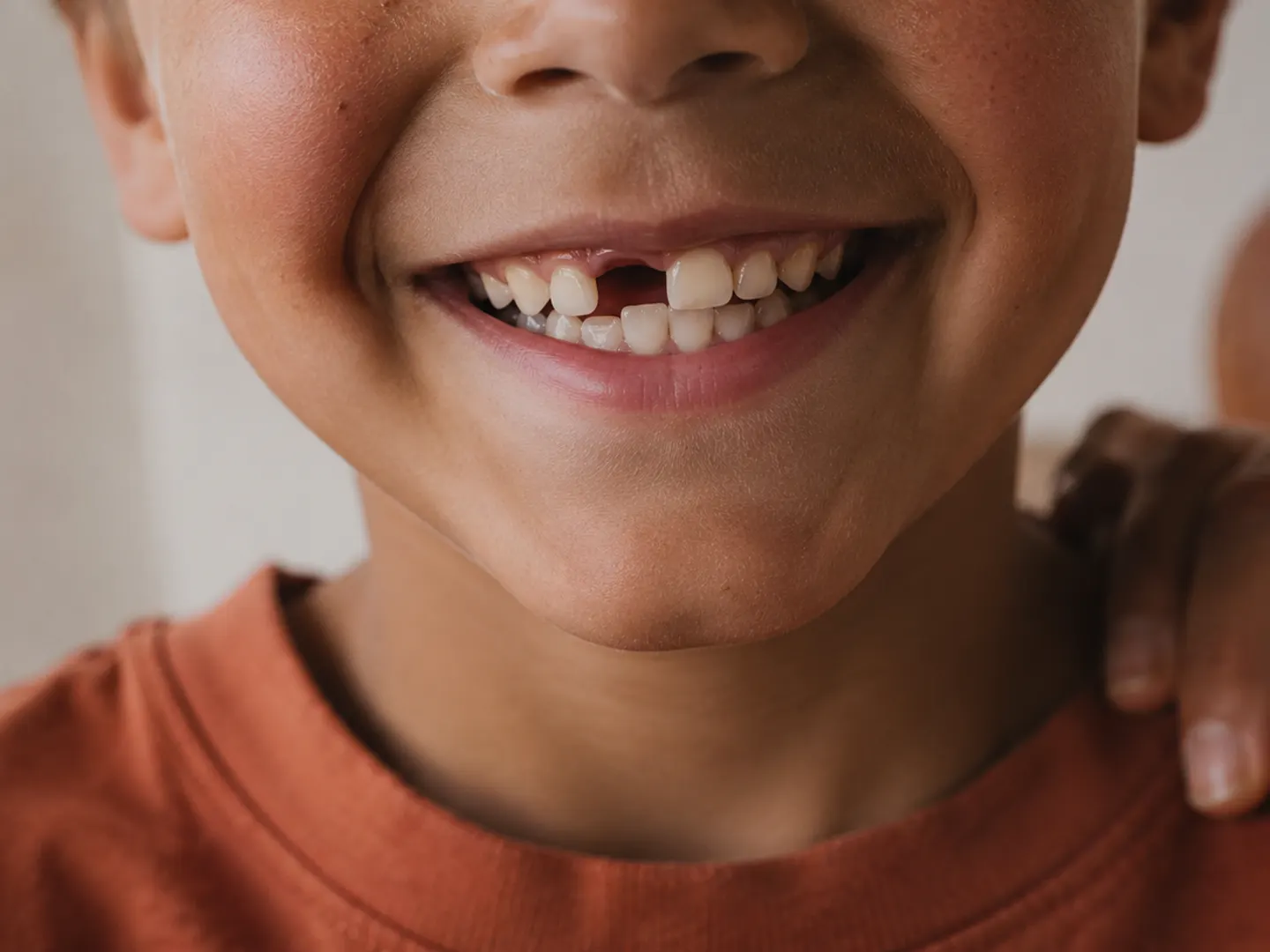 A young child grinning with a missing front baby tooth